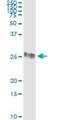 Glutathione S-Transferase Pi 1 antibody, H00002950-M01, Novus Biologicals, Immunoprecipitation image 