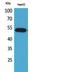 Leukocyte Immunoglobulin Like Receptor A2 antibody, A11081, Boster Biological Technology, Western Blot image 