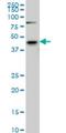 Serum/Glucocorticoid Regulated Kinase 2 antibody, H00010110-M08, Novus Biologicals, Western Blot image 