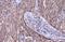 Serpin Family B Member 3 antibody, NBP2-20310, Novus Biologicals, Immunohistochemistry paraffin image 