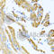 Collagen Type IX Alpha 3 Chain antibody, A9798, ABclonal Technology, Immunohistochemistry paraffin image 