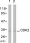 Cyclin Dependent Kinase 2 antibody, TA313153, Origene, Western Blot image 