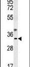 GTP Cyclohydrolase 1 antibody, PA5-25735, Invitrogen Antibodies, Western Blot image 