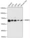 Sterol Regulatory Element Binding Transcription Factor 2 antibody, A01678-1, Boster Biological Technology, Western Blot image 