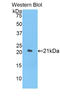 Interleukin 17 Receptor E antibody, LS-C294858, Lifespan Biosciences, Western Blot image 