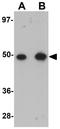 Transmembrane Protein 184B antibody, GTX85193, GeneTex, Western Blot image 