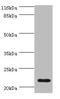 Complement C8 Gamma Chain antibody, A57261-100, Epigentek, Western Blot image 