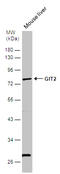 GIT ArfGAP 2 antibody, GTX116427, GeneTex, Western Blot image 