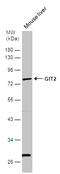 ARF GTPase-activating protein GIT2 antibody, GTX116427, GeneTex, Western Blot image 