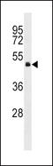 G Protein Subunit Alpha 13 antibody, LS-C166541, Lifespan Biosciences, Western Blot image 