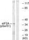 Eukaryotic Translation Initiation Factor 2 Subunit Alpha antibody, TA312128, Origene, Western Blot image 