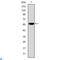 Fibrinogen Gamma Chain antibody, LS-C812601, Lifespan Biosciences, Enzyme Linked Immunosorbent Assay image 