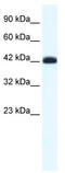 SLC2A4 Regulator antibody, TA331837, Origene, Western Blot image 