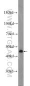 Beta-1,4-Galactosyltransferase 6 antibody, 20148-1-AP, Proteintech Group, Western Blot image 