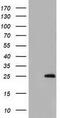 Glutathione S-transferase 5.7 antibody, GTX84404, GeneTex, Western Blot image 