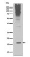 Small Ubiquitin Like Modifier 2 antibody, M01282-2, Boster Biological Technology, Western Blot image 