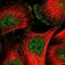 Thy-1 Cell Surface Antigen antibody, NBP1-85739, Novus Biologicals, Immunocytochemistry image 