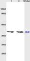 Opioid Related Nociceptin Receptor 1 antibody, OABF00089, Aviva Systems Biology, Western Blot image 