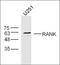 TNF Receptor Superfamily Member 11a antibody, orb312842, Biorbyt, Western Blot image 