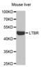 Lymphotoxin Beta Receptor antibody, abx004092, Abbexa, Western Blot image 