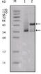 Estrogen Receptor 1 antibody, abx010735, Abbexa, Enzyme Linked Immunosorbent Assay image 