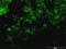 Tyrosinase antibody, H00007299-M01, Novus Biologicals, Immunocytochemistry image 