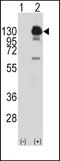 Platelet Derived Growth Factor Receptor Alpha antibody, LS-B9119, Lifespan Biosciences, Western Blot image 