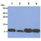 S100 Calcium Binding Protein A4 antibody, GTX57640, GeneTex, Western Blot image 