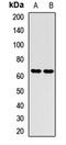 SET Domain Containing 3, Actin Histidine Methyltransferase antibody, orb412676, Biorbyt, Western Blot image 