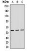 ADAM Like Decysin 1 antibody, LS-C354511, Lifespan Biosciences, Western Blot image 