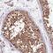 Adhesion Molecule With Ig Like Domain 1 antibody, PA5-61164, Invitrogen Antibodies, Immunohistochemistry frozen image 
