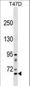 Rhophilin Rho GTPase Binding Protein 2 antibody, LS-C158853, Lifespan Biosciences, Western Blot image 