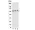 Eukaryotic Translation Initiation Factor 2 Alpha Kinase 1 antibody, R31133, NSJ Bioreagents, Western Blot image 