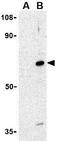 Apoptosis And Caspase Activation Inhibitor antibody, GTX31269, GeneTex, Western Blot image 