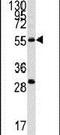 Chloride Intracellular Channel 5 antibody, PA5-14533, Invitrogen Antibodies, Western Blot image 