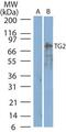 Transglutaminase 2 antibody, PA5-23219, Invitrogen Antibodies, Western Blot image 