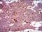 Dynactin Subunit 4 antibody, NBP2-37399, Novus Biologicals, Immunohistochemistry paraffin image 