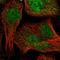 Transmembrane Protein 39A antibody, HPA039140, Atlas Antibodies, Immunofluorescence image 