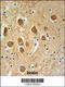 Sterile Alpha Motif Domain Containing 9 Like antibody, 61-816, ProSci, Immunohistochemistry paraffin image 