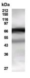 Histone Deacetylase 10 antibody, GTX30496, GeneTex, Western Blot image 