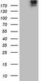 DNA Topoisomerase II Alpha antibody, LS-C789548, Lifespan Biosciences, Western Blot image 