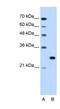 Forkhead Box R2 antibody, NBP1-80511, Novus Biologicals, Western Blot image 