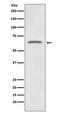 Tumor Protein P73 antibody, M00688, Boster Biological Technology, Western Blot image 