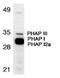 Acidic Nuclear Phosphoprotein 32 Family Member A antibody, A03625, Boster Biological Technology, Western Blot image 