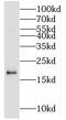 Methylmalonyl-CoA Epimerase antibody, FNab05049, FineTest, Western Blot image 