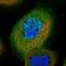 TBC1 Domain Containing Kinase antibody, NBP1-83166, Novus Biologicals, Immunofluorescence image 