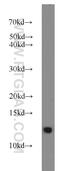 FKBP Prolyl Isomerase 1B antibody, 15114-1-AP, Proteintech Group, Western Blot image 