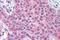 Matrix Metallopeptidase 13 antibody, NBP1-02339, Novus Biologicals, Immunohistochemistry paraffin image 