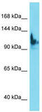 SKI/DACH domain-containing protein 1  antibody, TA334882, Origene, Western Blot image 