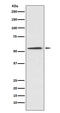 Vitamin K-dependent protein C antibody, M01742, Boster Biological Technology, Western Blot image 